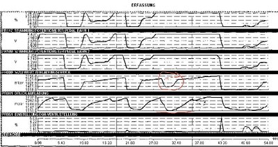 Laguna3_GT_Turboproblem2.jpg